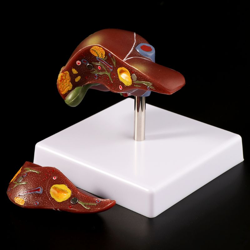 Medical Lab Design - 人間の肝臓病理学的解剖モデル解剖学校医療教育表示ツールラボ機器